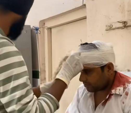 काशीपुर का सबसे बड़ा 'कोर्ट कांड': ACJM परिसर में वकीलों ने एक-दूसरे को पीटा, महिला पुलिसकर्मी भी घायल! 2 WhatsApp Image 2025 05 21 at 4.47.38 PM