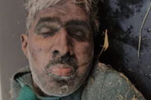 पेंटर का काम करता था मृतक, पुलिस ने शव पोस्टमार्टम के लिए भेजा जसपुर, 02 दिसंबर 2025 (समय बोल रहा) जसपुर में मंगलवार को सड़क किनारे एक अधेड़ व्यक्ति का शव बरामद होने से हड़कंप मच गया। पुलिस ने तत्काल शव को कब्जे में लेकर सरकारी अस्पताल पहुंचाया, जहां डॉक्टरों ने उसे मृत घोषित कर दिया। घटना की जानकारी देते हुए एसएसआई जावेद मलिक ने बताया कि मंगलवार को कलियावाला सड़क पर लगभग 55 वर्षीय एक व्यक्ति मृत अवस्था में पड़ा मिला। प्रथम दृष्टया ऐसा प्रतीत हुआ कि व्यक्ति नशे की हालत में था। पुलिस टीम तुरंत मौके पर पहुंची और अधेड़ को सरकारी अस्पताल ले गई। अस्पताल में, ईएमओ (Emergency Medical Officer) ने जांच के बाद उसे मृत घोषित कर दिया। शिनाख्त हुई पूरी पुलिस ने शव की शिनाख्त के प्रयास किए, जिसमें मृतक की पहचान सलीम (पुत्र अब्दुल सलाम), निवासी पप्पू कॉलोनी, जसपुर के रूप में हुई है। एसएसआई मलिक ने बताया कि मृतक सलीम पेंटर का काम करता था। पुलिस ने आवश्यक कानूनी औपचारिकताएं पूरी करने के बाद शव को पोस्टमार्टम के लिए भेज दिया है। पुलिस मामले की जांच कर रही है कि मृत्यु अत्यधिक नशे के कारण हुई है या इसके पीछे कोई अन्य कारण है।