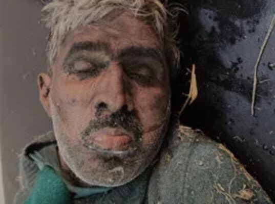 पेंटर का काम करता था मृतक, पुलिस ने शव पोस्टमार्टम के लिए भेजा जसपुर, 02 दिसंबर 2025 (समय बोल रहा) जसपुर में मंगलवार को सड़क किनारे एक अधेड़ व्यक्ति का शव बरामद होने से हड़कंप मच गया। पुलिस ने तत्काल शव को कब्जे में लेकर सरकारी अस्पताल पहुंचाया, जहां डॉक्टरों ने उसे मृत घोषित कर दिया। घटना की जानकारी देते हुए एसएसआई जावेद मलिक ने बताया कि मंगलवार को कलियावाला सड़क पर लगभग 55 वर्षीय एक व्यक्ति मृत अवस्था में पड़ा मिला। प्रथम दृष्टया ऐसा प्रतीत हुआ कि व्यक्ति नशे की हालत में था। पुलिस टीम तुरंत मौके पर पहुंची और अधेड़ को सरकारी अस्पताल ले गई। अस्पताल में, ईएमओ (Emergency Medical Officer) ने जांच के बाद उसे मृत घोषित कर दिया। शिनाख्त हुई पूरी पुलिस ने शव की शिनाख्त के प्रयास किए, जिसमें मृतक की पहचान सलीम (पुत्र अब्दुल सलाम), निवासी पप्पू कॉलोनी, जसपुर के रूप में हुई है। एसएसआई मलिक ने बताया कि मृतक सलीम पेंटर का काम करता था। पुलिस ने आवश्यक कानूनी औपचारिकताएं पूरी करने के बाद शव को पोस्टमार्टम के लिए भेज दिया है। पुलिस मामले की जांच कर रही है कि मृत्यु अत्यधिक नशे के कारण हुई है या इसके पीछे कोई अन्य कारण है।