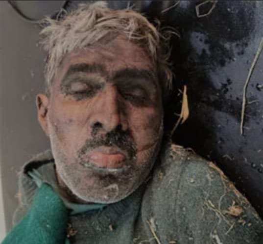 पेंटर का काम करता था मृतक, पुलिस ने शव पोस्टमार्टम के लिए भेजा जसपुर, 02 दिसंबर 2025 (समय बोल रहा) जसपुर में मंगलवार को सड़क किनारे एक अधेड़ व्यक्ति का शव बरामद होने से हड़कंप मच गया। पुलिस ने तत्काल शव को कब्जे में लेकर सरकारी अस्पताल पहुंचाया, जहां डॉक्टरों ने उसे मृत घोषित कर दिया। घटना की जानकारी देते हुए एसएसआई जावेद मलिक ने बताया कि मंगलवार को कलियावाला सड़क पर लगभग 55 वर्षीय एक व्यक्ति मृत अवस्था में पड़ा मिला। प्रथम दृष्टया ऐसा प्रतीत हुआ कि व्यक्ति नशे की हालत में था। पुलिस टीम तुरंत मौके पर पहुंची और अधेड़ को सरकारी अस्पताल ले गई। अस्पताल में, ईएमओ (Emergency Medical Officer) ने जांच के बाद उसे मृत घोषित कर दिया। शिनाख्त हुई पूरी पुलिस ने शव की शिनाख्त के प्रयास किए, जिसमें मृतक की पहचान सलीम (पुत्र अब्दुल सलाम), निवासी पप्पू कॉलोनी, जसपुर के रूप में हुई है। एसएसआई मलिक ने बताया कि मृतक सलीम पेंटर का काम करता था। पुलिस ने आवश्यक कानूनी औपचारिकताएं पूरी करने के बाद शव को पोस्टमार्टम के लिए भेज दिया है। पुलिस मामले की जांच कर रही है कि मृत्यु अत्यधिक नशे के कारण हुई है या इसके पीछे कोई अन्य कारण है।